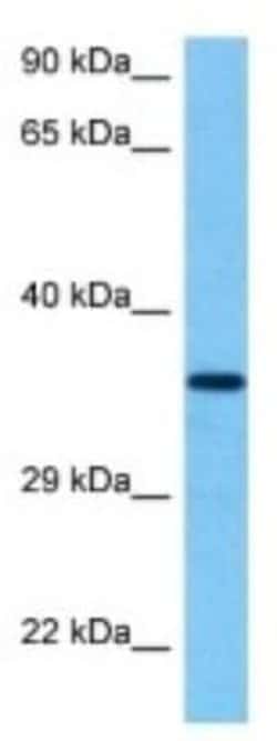 ARHGAP19 Rabbit anti-Human, Polyclonal, Novus Biologicals 100 &mu;g; Unconjugated:Antibodies,
